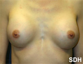 Patient # 37304 After Photo # 2
